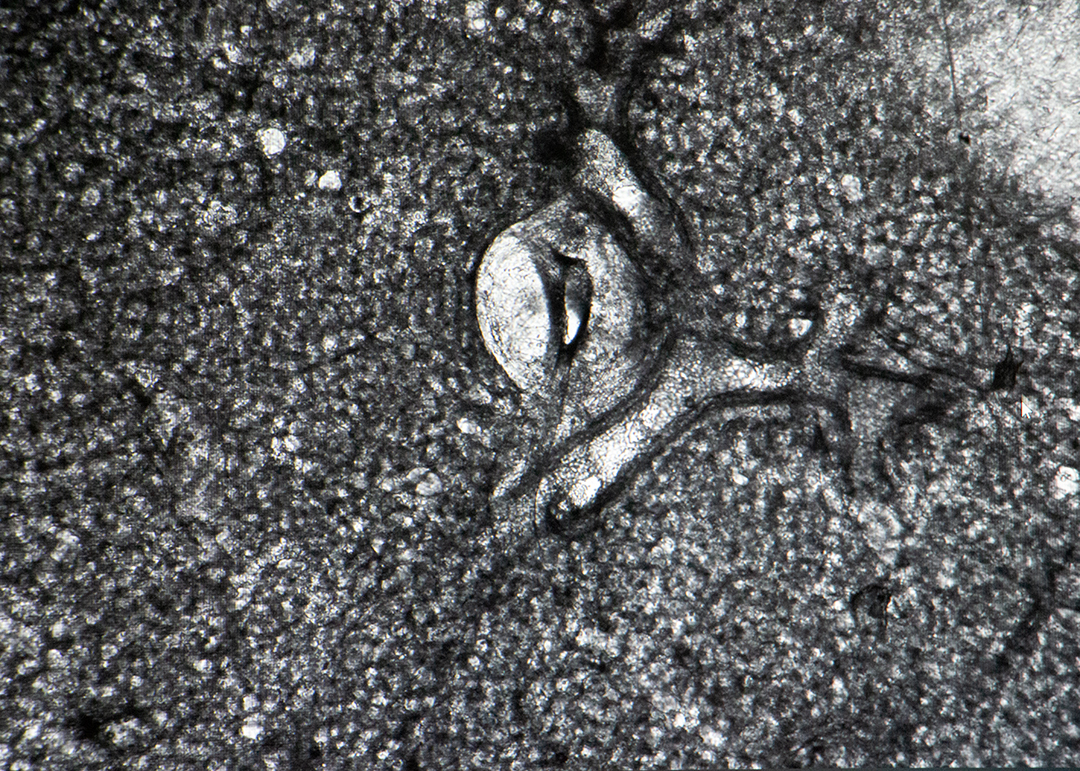 a microscopic view of lung tissue