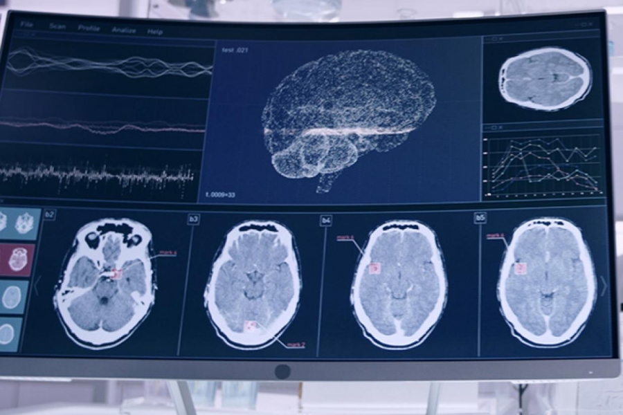 Brain scans on the left and a scientist looking through a microscope on the right