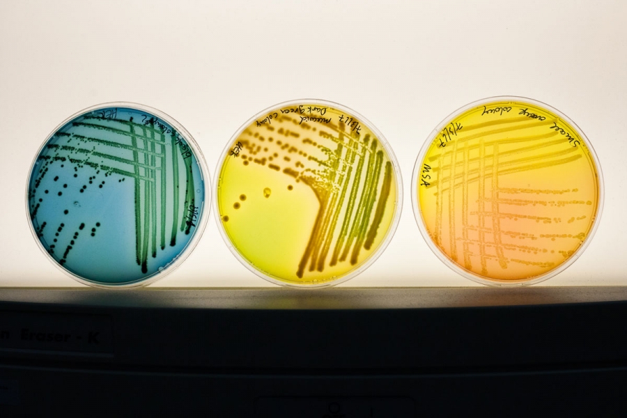 petri dishes