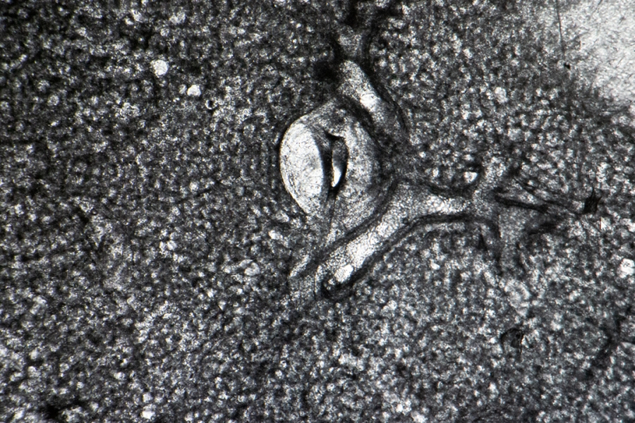 a microscopic view of lung tissue