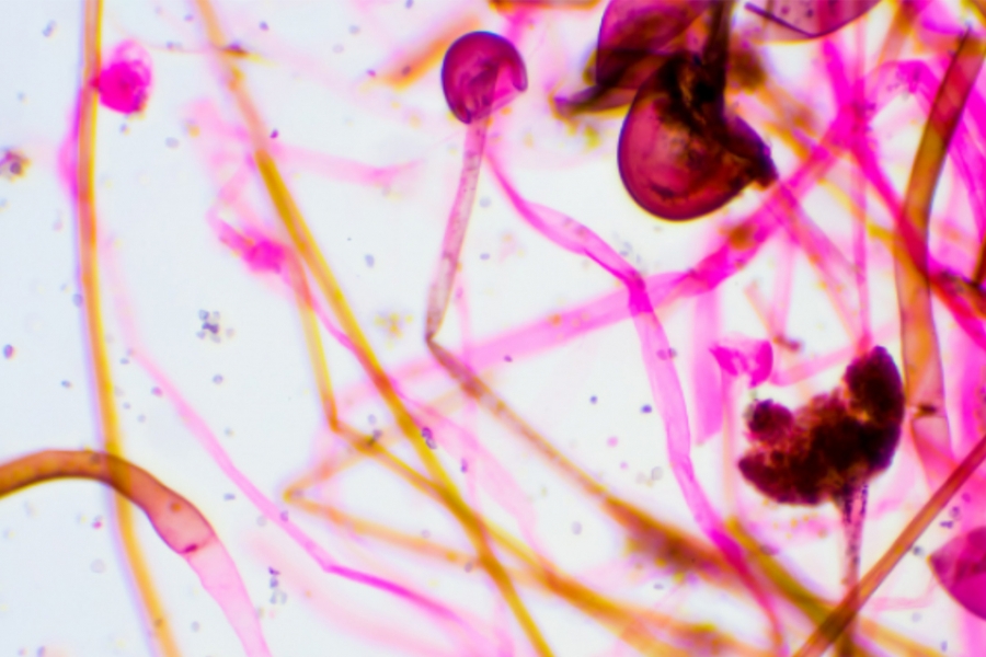 Biological Sciences photo with fungus.