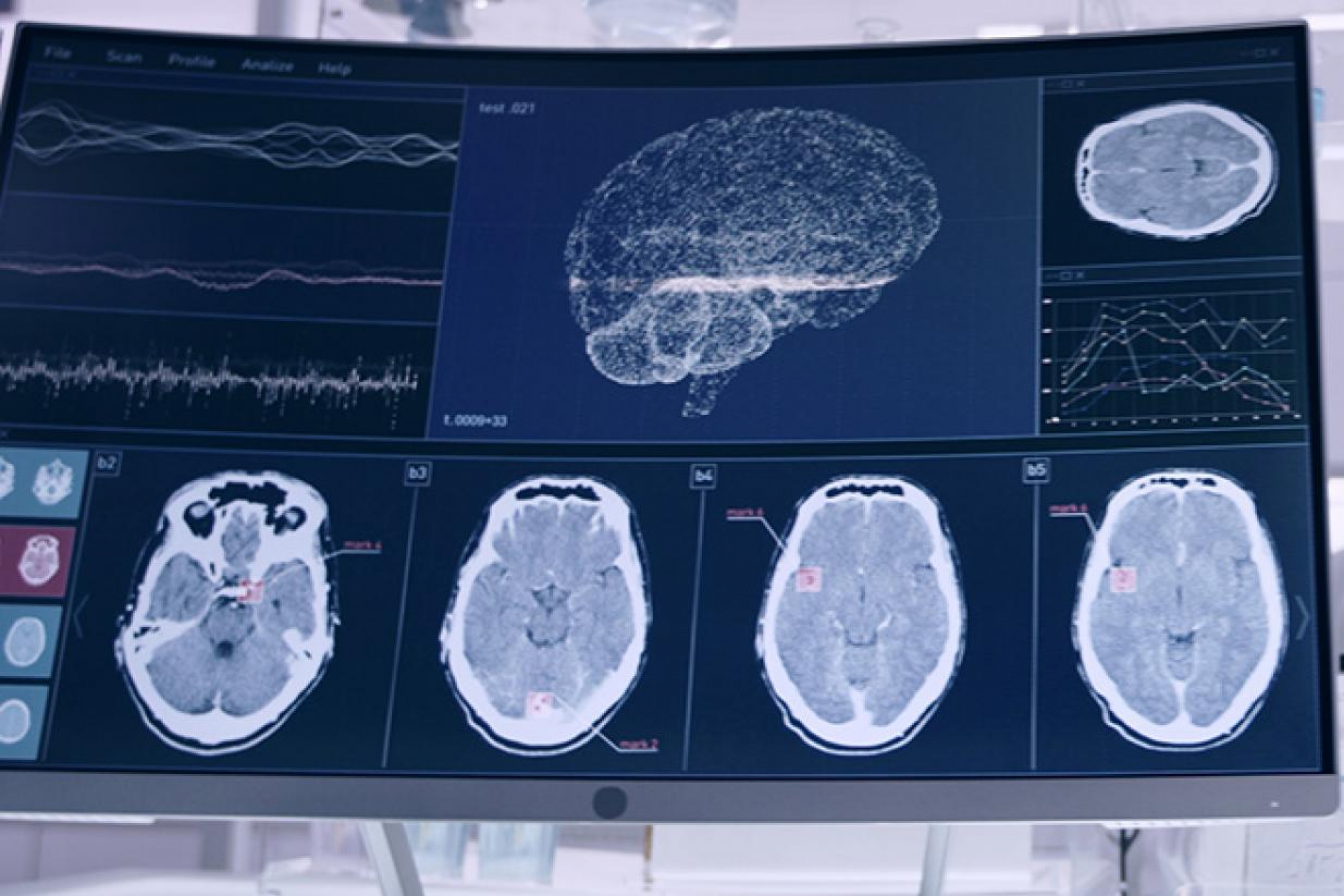 Brain scans on the left and a scientist looking through a microscope on the right