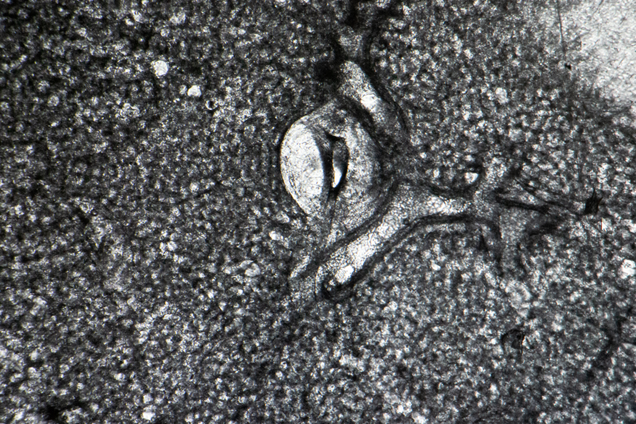 a microscopic view of lung tissue